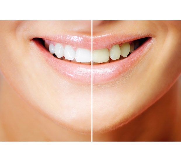 San Bruno Cosmetic Dental Services
