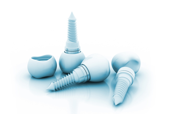 Eight Things To Ask About Dental Implants